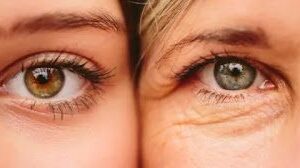 ٥ خطوات للعناية بالجلد حول العين