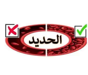 علاج نقص الحديد