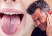 أعراض سرطان الفم المبكرة
