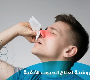 روشتة لعلاج الجيوب الأنفية