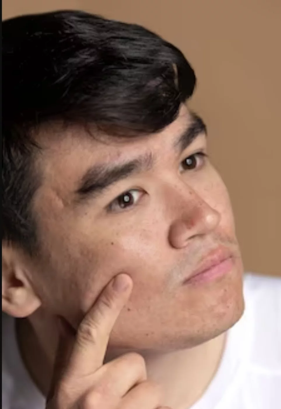 ايزوتريتينوين لعلاج حب الشباب هل أيزوتريتينوين لعلاج حب الشباب يزيل أثار الحبوب؟