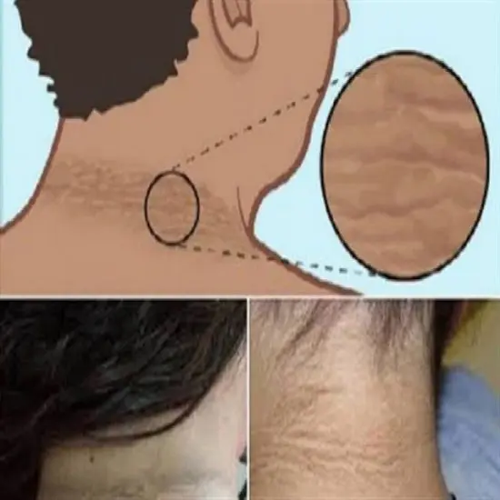 الجلد الداكن