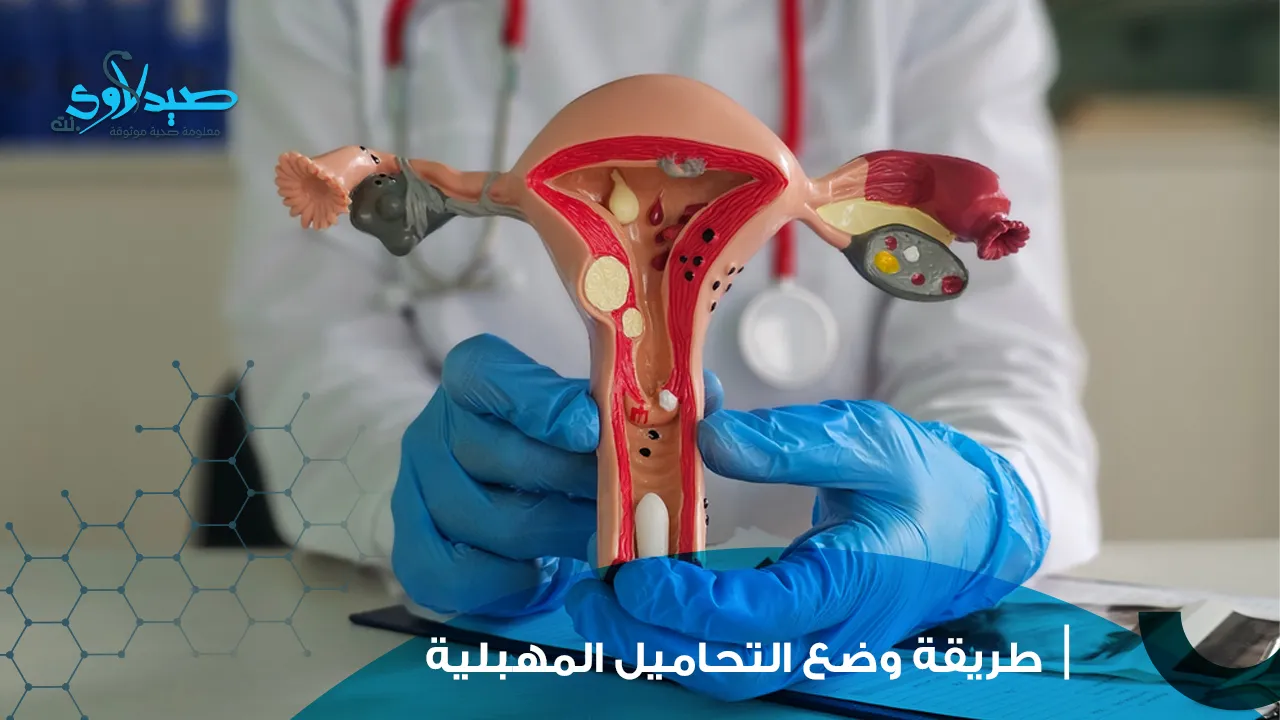 وضع التحاميل المهبلية