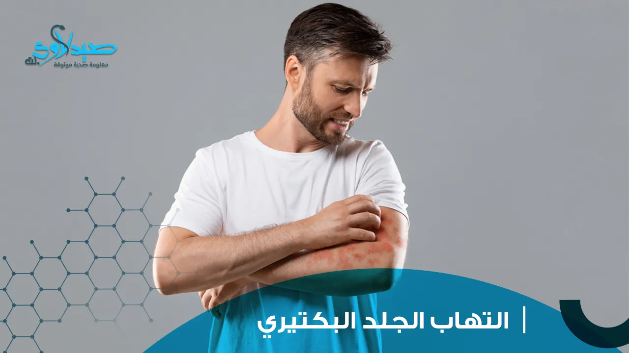 التهاب الجلد البكتيري