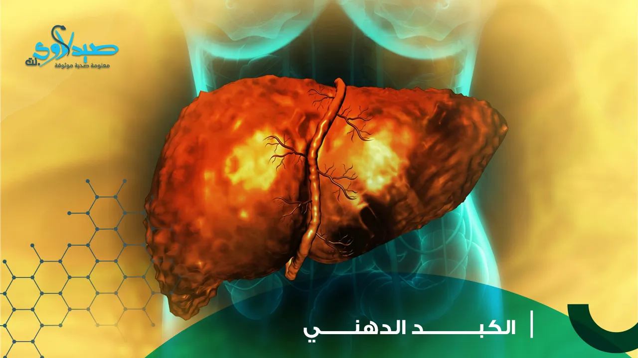 الكبد الدهني
