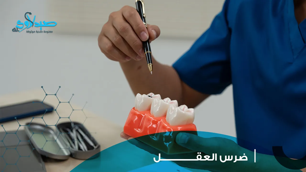 ضرس العقل