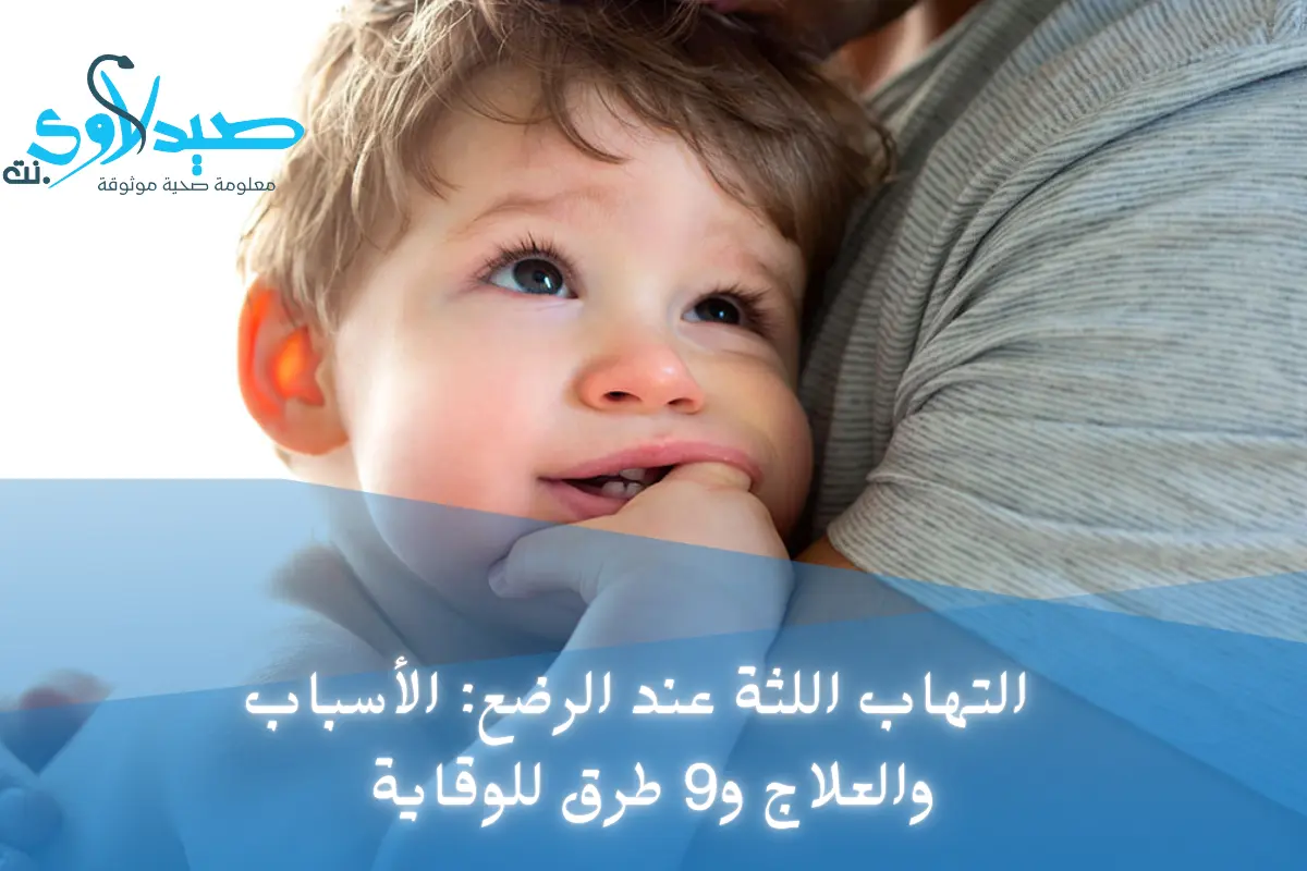 التهاب اللثة عند الرضع: الأسباب والاعراض والعلاج و9 طرق للوقاية من الالتهابات