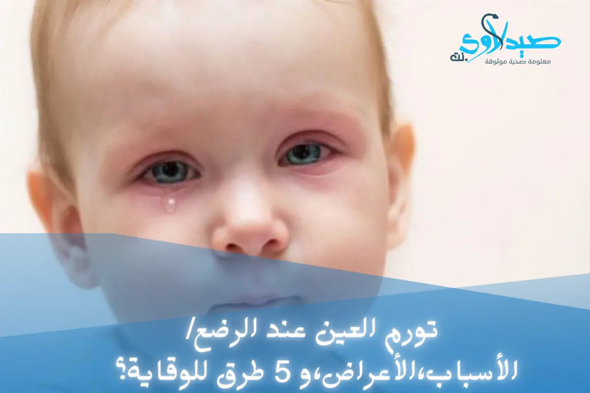 تورم العين عند الرضع