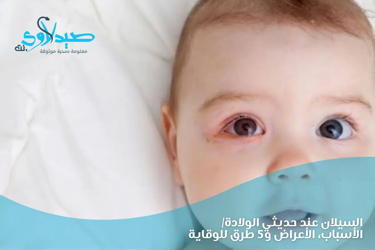 السيلان عند حديثي الولادة: الأسباب،الأعراض و5 طرق للوقاية