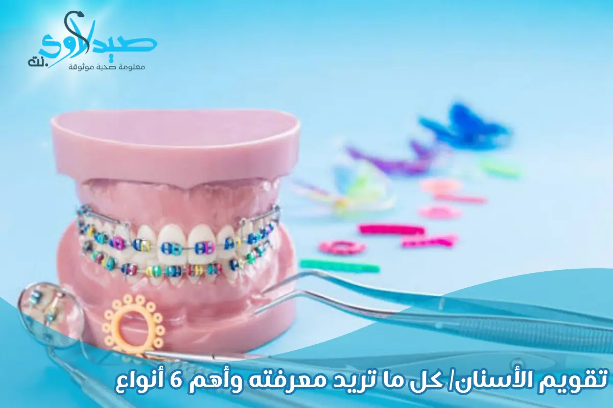 تقويم الأسنان: كل ما تريد معرفته وأهم 6 أنواع رحلتك نحو أسنان متناسقة وابتسامة مميزة تعزز ثقتك بنفسك