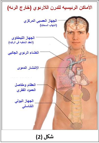 مرض السل: تعرف على الأسباب والأعراض والأنواع وطرق العلاج