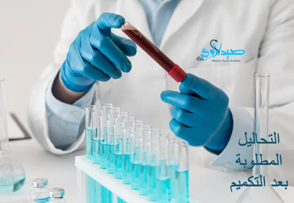 التحاليل المطلوبة بعد التكميم