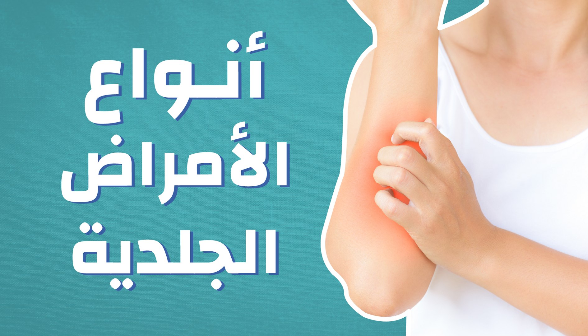 أنواع الأمراض الجلدية