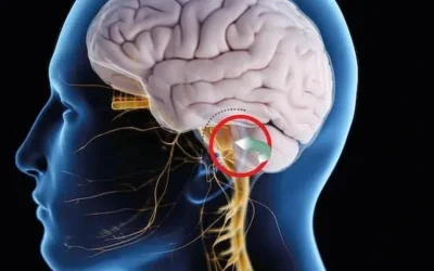 التهاب العصب الخامس