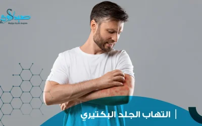 التهاب الجلد البكتيري