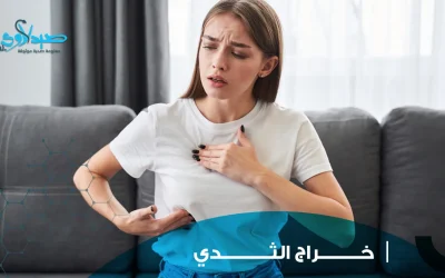 خراج الثدي