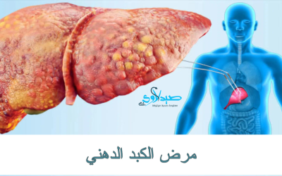 مرض الكبد الدهني